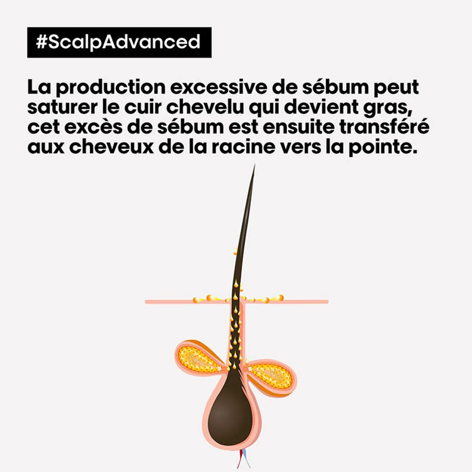 Routine anti-gras Scalp Advanced