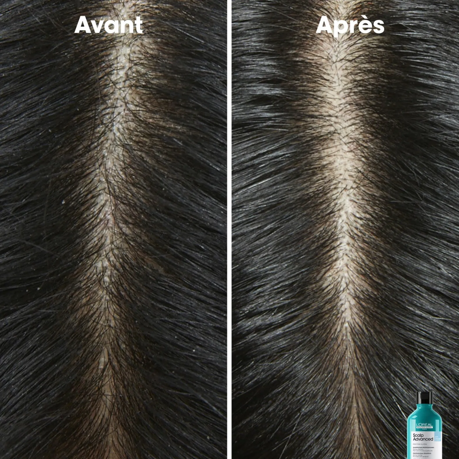 Shampooing dermo-clarifiant anti-pelliculaire Scalp Advanced 500ml