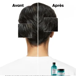 Shampooing dermo-purifiant anti-gras Scalp Advanced 300ml