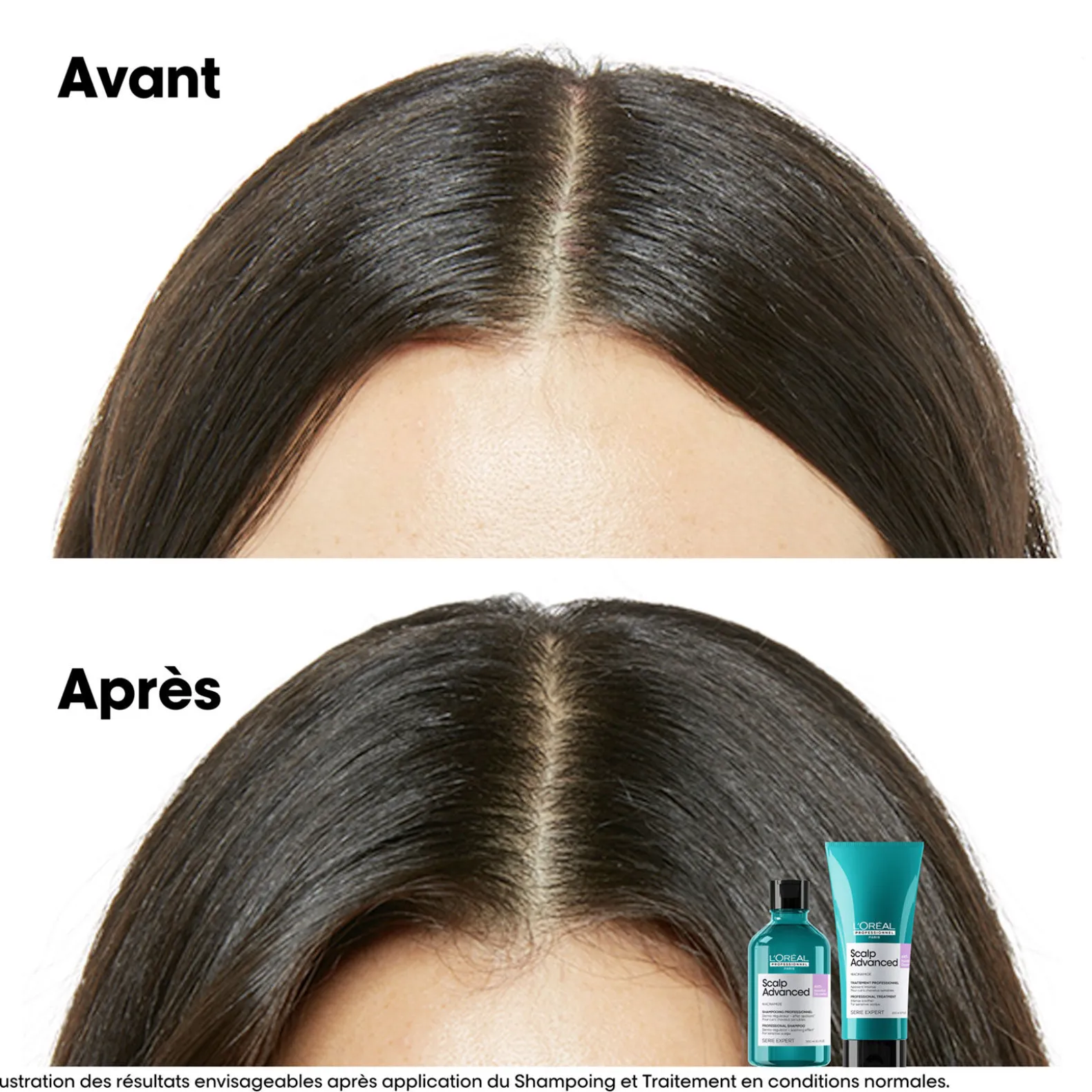 Shampooing dermo-régulateur anti-inconfort Scalp Advanced 1500ml